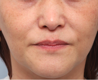 『セラピューティックコース開始！』