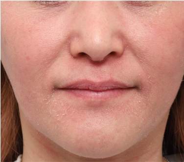 『耐久期』開始から12週間後