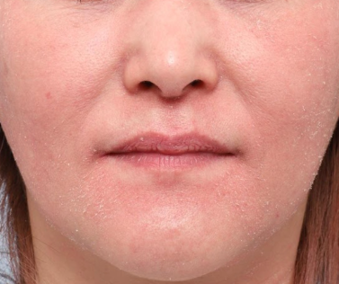 『完成期』開始から17週間後