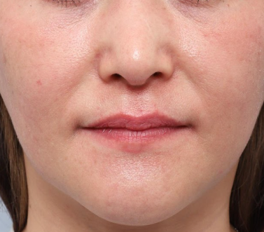 『コース終了後』開始から21週間後