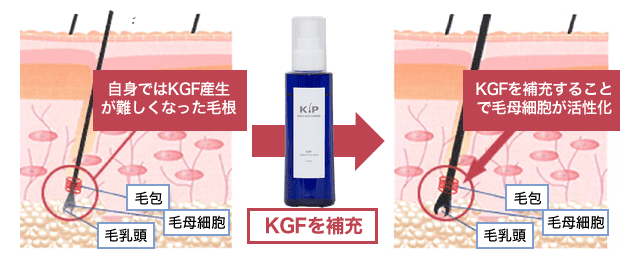 KIPスカルプヘアエッセンス （男性・女性用頭皮育毛剤）｜仙台市の美容