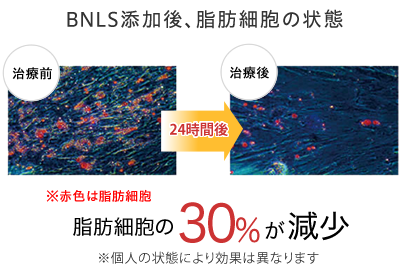 BNLS注射による脂肪細胞反応実験