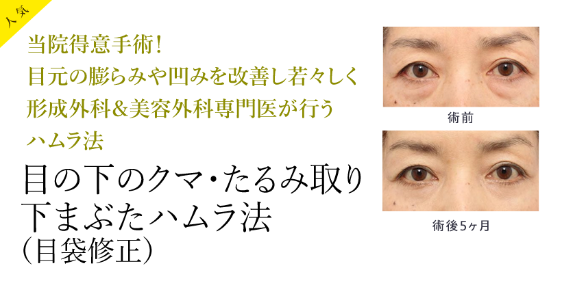 下はぶたハムラ法（目袋修正）